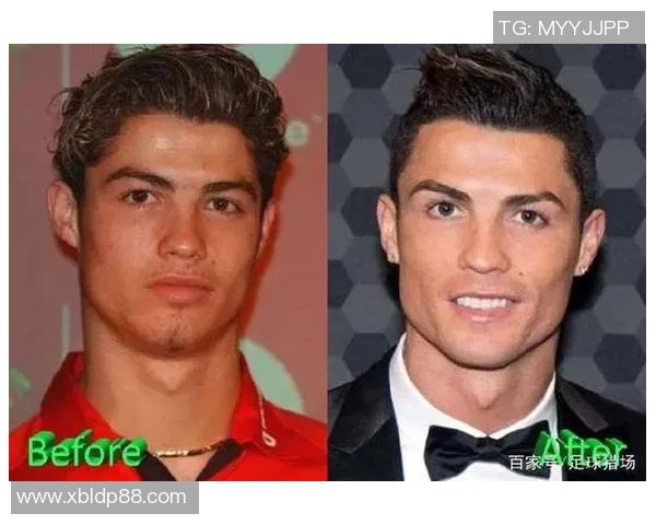 整容前后对比照解析：男足球星颜值变化大集合